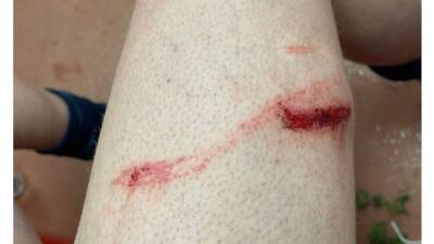 Stuart Armstrong - Laporte muestra el 'regalo' de Stuart Armstrong - en.as.com - Manchester