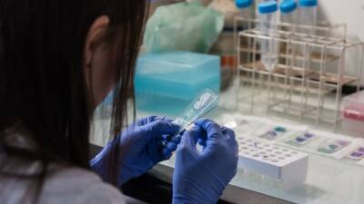 Descubren un biomarcador que permite la detección precoz del cáncer de páncreas - en.as.com