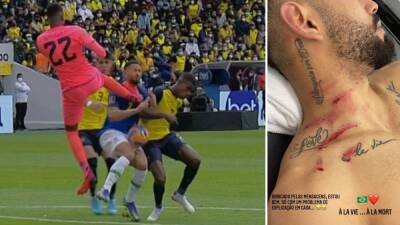 Cunha se toma con guasa la patada: "Solo un problema, a ver cómo explico esto en casa..." - en.as.com - Ecuador