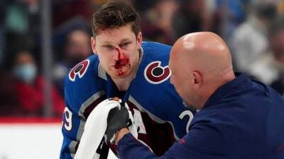Joe Pavelski - Dallas Stars - Jared Bednar - Nathan Mackinnon - Montreal Canadiens - Avalanche's MacKinnon to miss all-star game after surgery for broken nose - cbc.ca - Washington -  Boston - New York -  Chicago -  Las Vegas - state Colorado -  Nashville