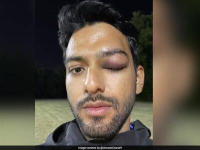 "Grateful To God To Have Survived A Possible Disaster": Unmukt Chand Shares Pics Of Eye Injury - sports.ndtv.com - Usa - Australia - India -  Delhi