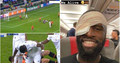 Antonio Rudiger injury: Real Madrid star proves he’s an absolute warrior