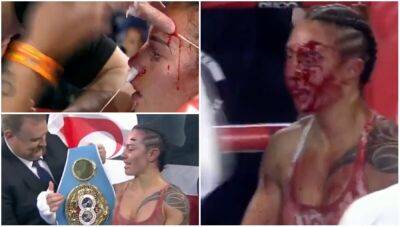 Cherneka Johnson left drenched in blood after brutal Susie Ramadan fight