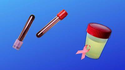 A cheap new blood test can detect 14 types of cancer before they spread - euronews.com - Britain - Sweden