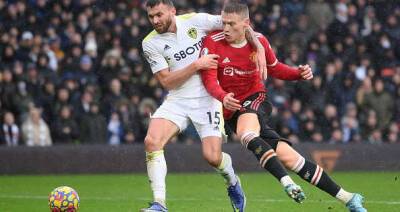 Scott McTominay showed the world his battle scars after somehow escaping red card vs Leeds