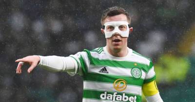 Celtic make stark admission on performances - team is now 'under more pressure'