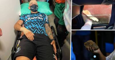 Gremio bus attacked & windows smashed by rival Internacional fans as Mathias Villasanti needs hospital treatment