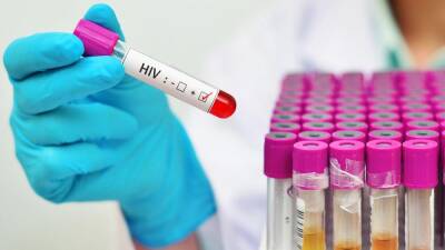 VB variant: What we know about the new highly virulent HIV strain found in the Netherlands