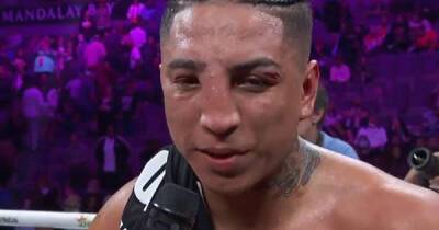 Manny Pacquiao - Boxer Mario Barrios left with disfigured nose after losing almost every round of fight - msn.com - Mexico - county Santa Cruz