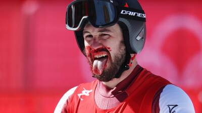 'That is Olympic commitment!' - Daniel Hemetsberger left with 'smashed-in face' after big crash in downhill