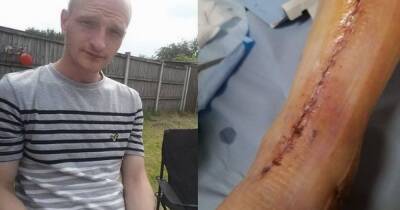 Christmas Eve - Chef 'left for dead' after being mowed down in hit-and-run by taxi on Christmas Day - manchestereveningnews.co.uk