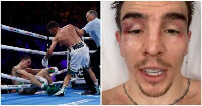 Michael Conlan KO: Irish boxer shows off nasty facial injuries