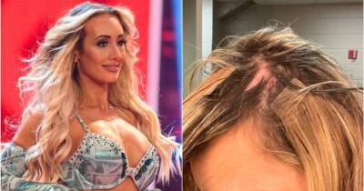WWE star shows off gruesome head wound from live event match
