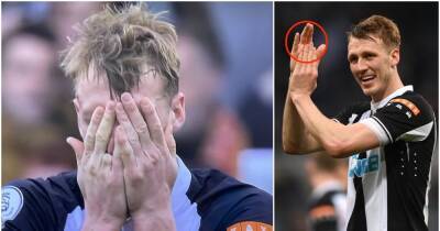 Dan Burn finger: The story behind Newcastle defender's missing digit