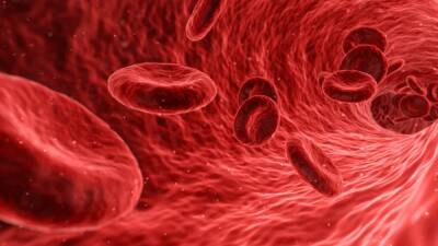 Golpe al colesterol: la novedosa técnica que limpia las arterias