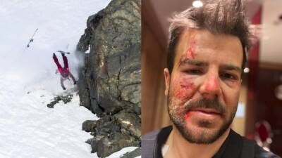 Freeride | Aymar Navarro se recupera de sus heridas tras su brutal caída