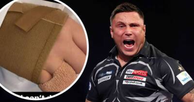 Gerwyn Price to play with fractured hand as charity boxing bout delayed - msn.com - Germany - Birmingham -  Brighton