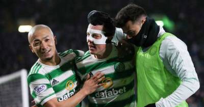 Callum Macgregor - Why Celtic might alter the game plan to combat Livingston 'heebee-jeebies' - msn.com - Scotland