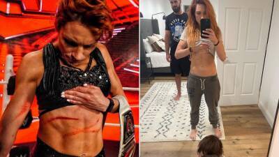 WWE: Becky Lynch says daughter Roux 'can't even look' at her injuries