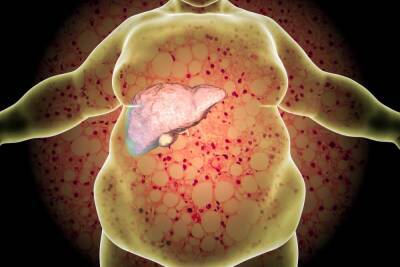 6 señales que alertan del hígado graso - Mejor con Salud