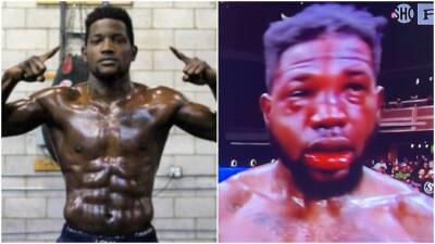 Worst boxing injuries: Erickson Lubin’s face was unrecognisable after severe punishment - givemesport.com -  Las Vegas