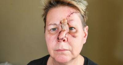 Woman left with horrific facial injuries after being mauled by dog in the street - manchestereveningnews.co.uk