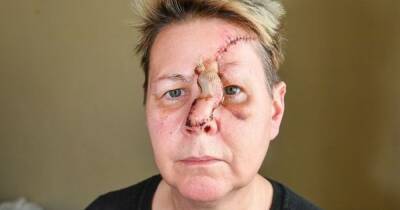Woman suffers horrific injuries after being mauled by dog she was told was friendly