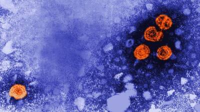 Hepatitis de origen desconocido en España: cuáles son sus síntomas