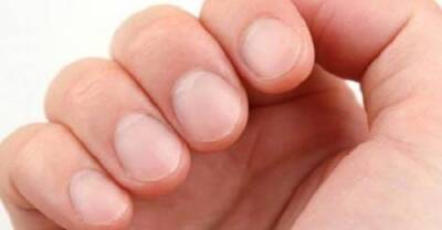 8 señales de advertencia de salud que tus uñas podrían estar revelando - Mejor con Salud