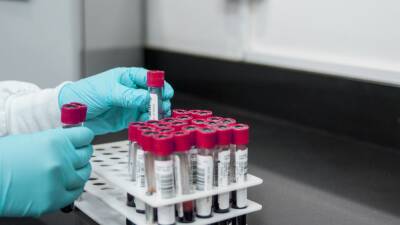 Hallan el primer anticuerpo que ataca las células madre del cáncer - en.as.com