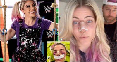 WWE: Alexa Bliss looked unrecognisable in brutal nose surgery recovery video