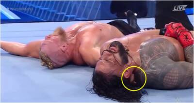 Brock Lesnar - Roman Reigns - Roman Reigns WWE WrestleMania 38 injury: Brock Lesnar caught checking on opponent - givemesport.com