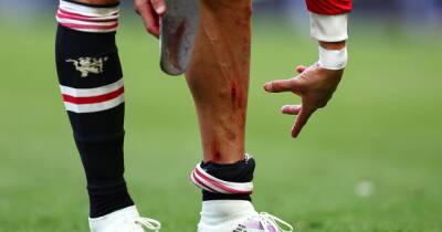 Cristiano Ronaldo limps off with brutal injury after Manchester United's defeat to Everton