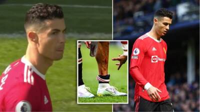 Cristiano Ronaldo: Man Utd star shows off leg injury after Everton loss