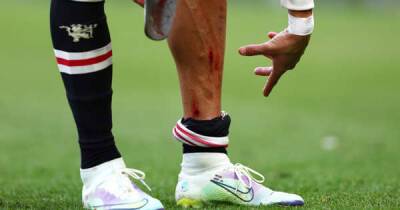 Cristiano Ronaldo - Anthony Gordon - The state of Cristiano Ronaldo’s leg at full-time of Everton 1-0 Man Utd was sad to see - msn.com - Manchester - Portugal - Jordan
