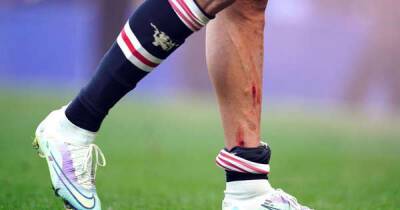 Cristiano Ronaldo shows off bloody and wounded leg as Man Utd star limps down tunnel
