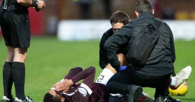 Cup final blow as Hearts defender Toby Sibbick leaves field on a stretcher in defeat by Motherwell