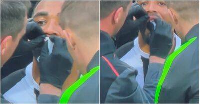 Callum Wilson - Newcastle's Callum Wilson's tooth was hanging by a thread after clash vs Arsenal - givemesport.com