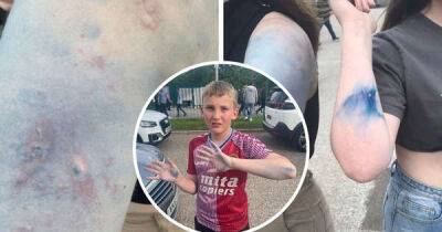 Coins, lighters, flares - Aston Villa fans left 'choking, bruised and burnt by Man City yobs' - msn.com - Manchester -  Man