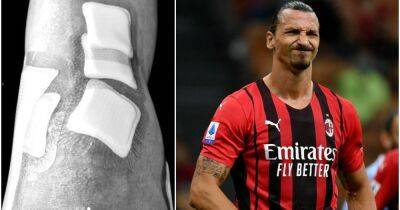 Zlatan Ibrahimovic: AC Milan star reveals extent of hellish knee injury