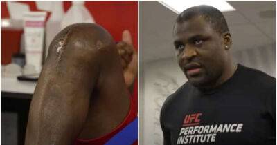 Francis Ngannou shows off insane scar from surgery ahead of UFC comeback