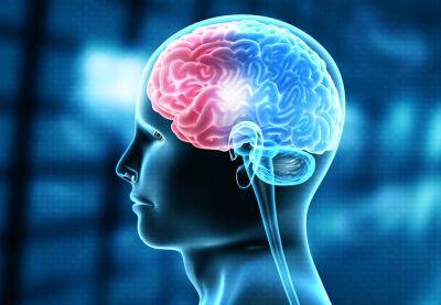 8 advertencias de un infarto cerebral - Mejor con Salud