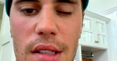 Justin Bieber suffering from 'face paralysis' as upcoming shows cancelled