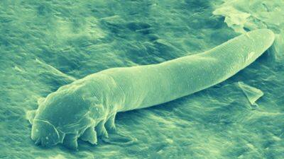 Health - Skin mites that mate on our faces may be becoming at one with humans - euronews.com -  Vienna - county San Juan