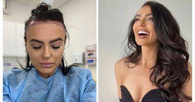 ITV Love Island beauty underwent secret hair transplant after 'sitting in tears with chunks of hair in my hands'