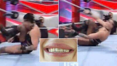 Wwe Raw - Rhea Ripley - WWE: Rhea Ripley needed dental work after suffering unfortunate injury - givemesport.com