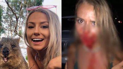 American woman attacked on holiday warns others to take out full travel insurance