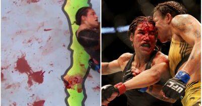 Julianna Pena - Amanda Nunes - UFC 277: Amanda Nunes splatters Octagon with Julianna Peña’s blood in unanimous win - givemesport.com - Brazil - county Dallas
