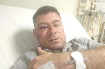 Former Bok assaulted at nightclub after Mbombela Test - news24.com - South Africa - New Zealand -  Pretoria