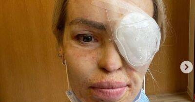 ITV Loose Women's Katie Piper undergoes emergency operation after husband noticed black spot in eye